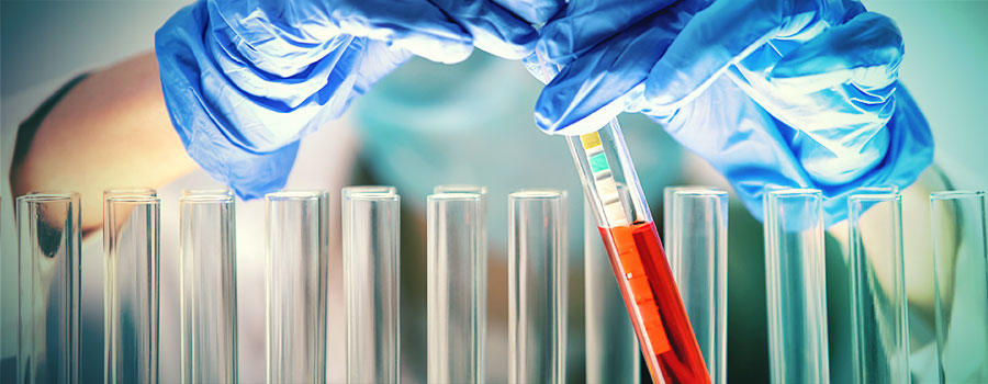 STRES ZWIĄZANY Z POZIOMEM PH