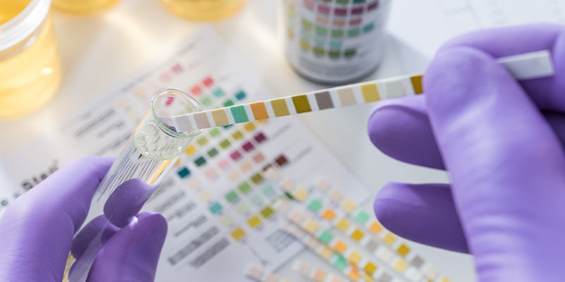 Czy kratom wykaże test narkotykowy?