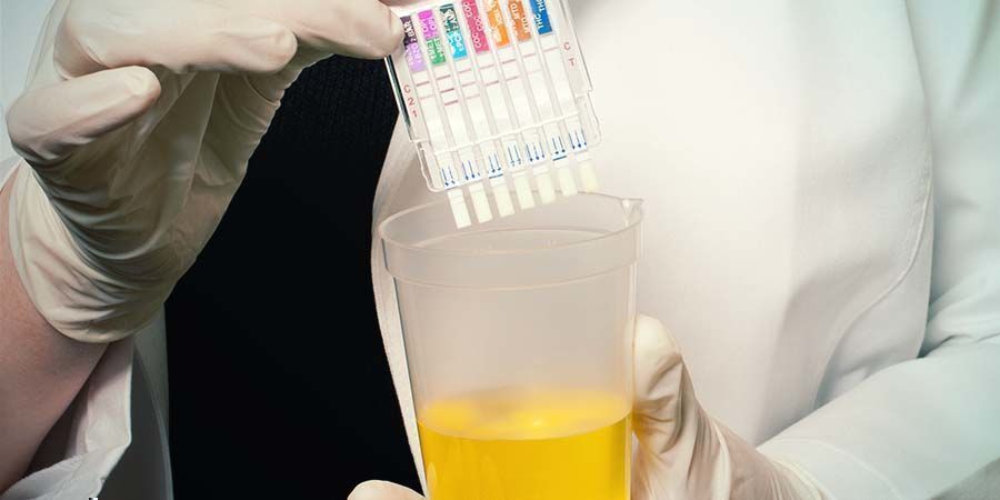 Podczas testu narkotykowego Podczas testu narkotykowego