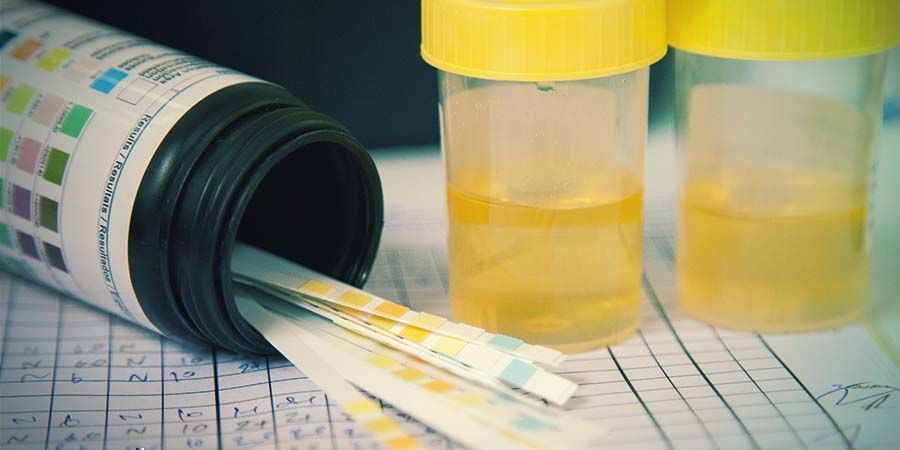 Mocz drug testing methods: Urine