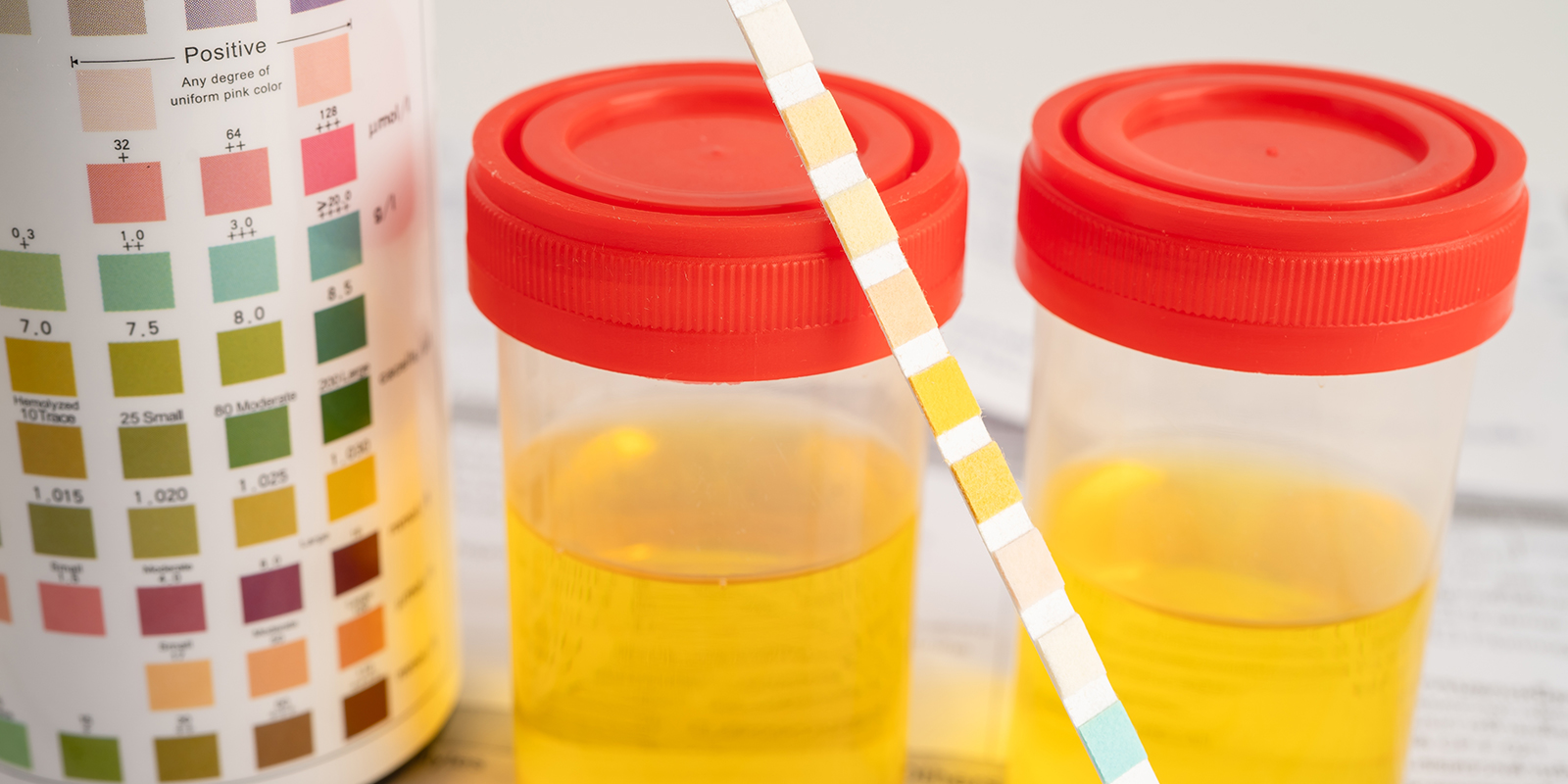 Okna wykrywalności Okna wykrywalności