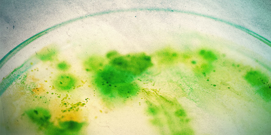 What Are Algae, And How Does It Develop? WHAT ARE ALGAE, AND HOW DOES IT DEVELOP?
