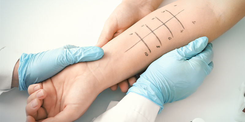 Rozpoznawanie alergii na marihuanę Rozpoznawanie alergii na marihuanę