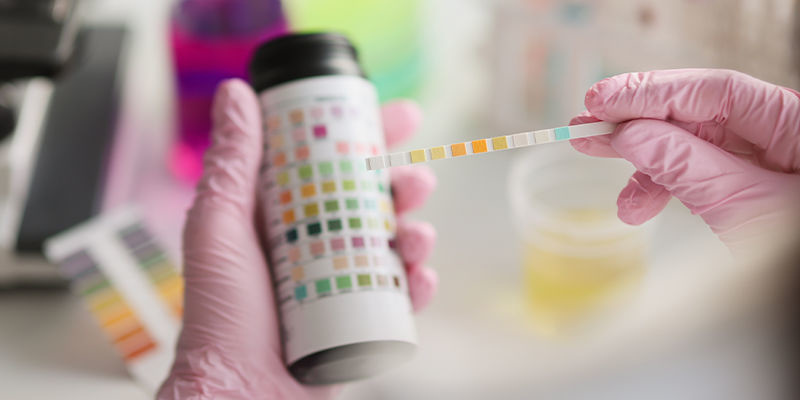 Badanie krwi na obecność kratomu