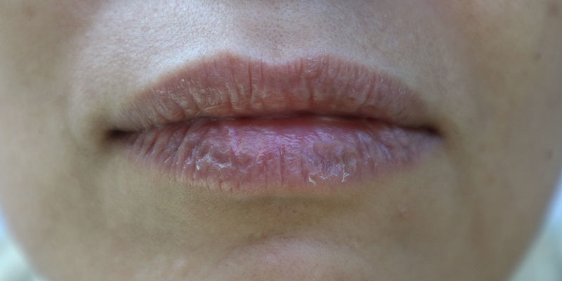 Możliwe skutki uboczne kratomu