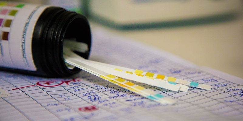 Badanie narkotykowe ze śliny i moczu Badanie narkotykowe ze śliny i moczu