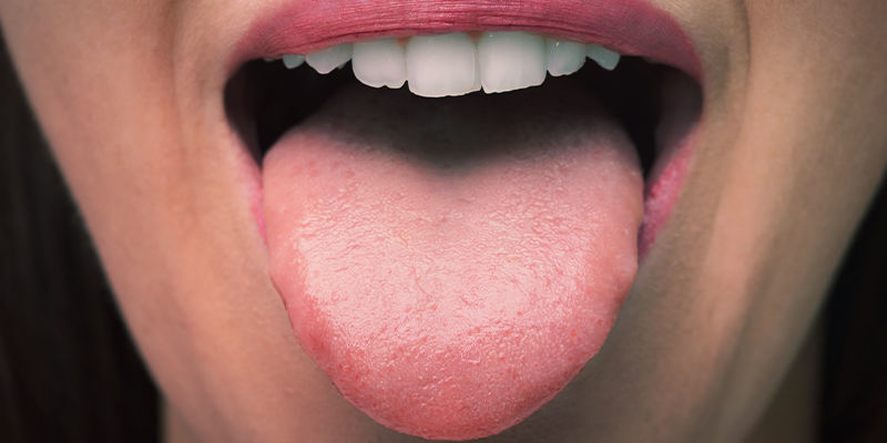 Cotton Mouth Cotton Mouth