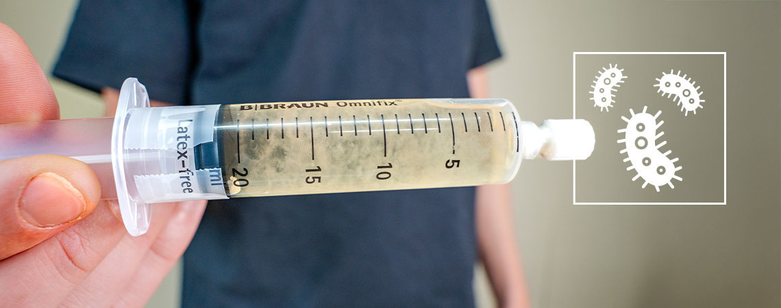 Czym jest płynna kultura? Kompletny przewodnik dla początkujących Czym jest płynna kultura? Kompletny przewodnik dla początkujących