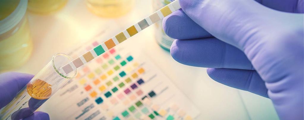 Drug Tests: What You Need To Know 