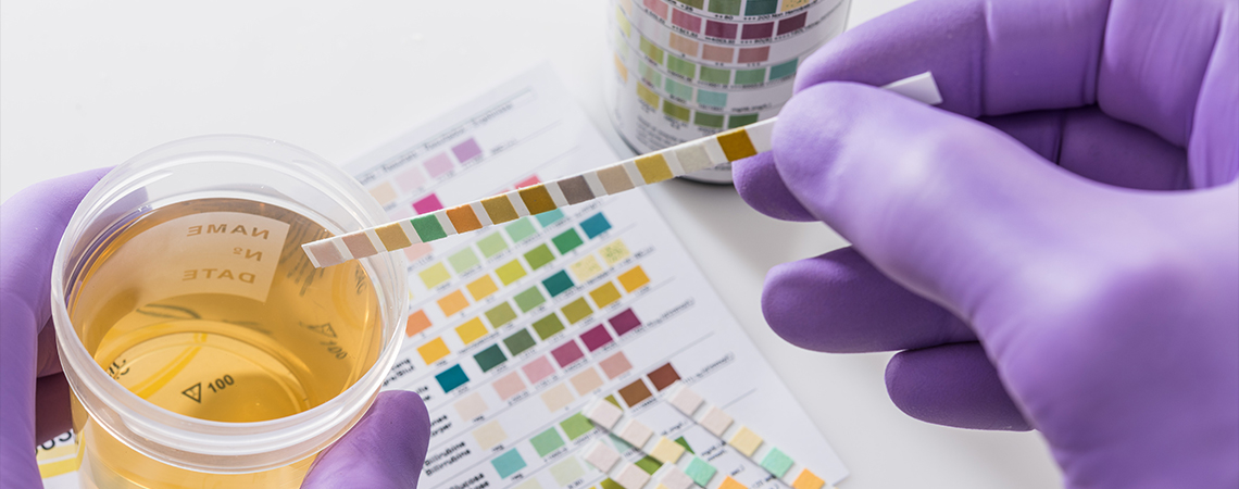 Popularne sposoby kontra rzeczywistość: czy da się naprawdę oszukać test narkotykowy z moczu?