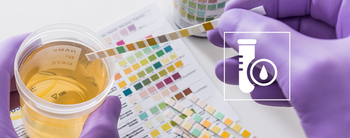 How To Pass A THC Drug Test (2025)