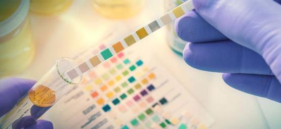 Badania na obecność narkotyków: co musisz wiedzieć