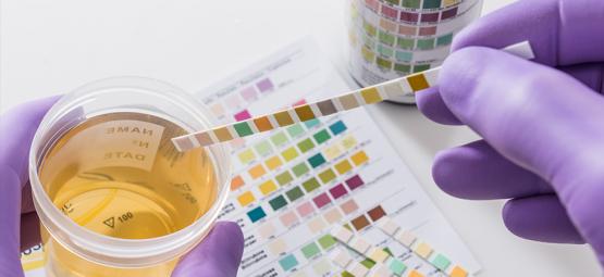 Popularne sposoby kontra rzeczywistość: czy da się naprawdę oszukać test narkotykowy z moczu?