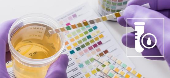 Jak zdać test na THC (2025)